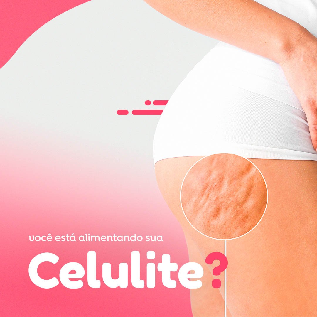 Leia mais sobre o artigo Celulite por que?